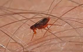 The good news is that most fleas can't really survive on human skin, thanks to our relative lack of body hair. Fleas A Guide To Dallas North Tx Flea Control