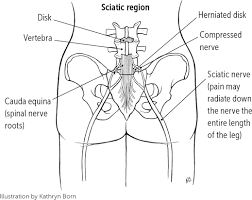 The muscles of the lower back, including the erector spinae and quadratus lumborum muscles, contract to extend and laterally bend the vertebral the thoracolumbar fascia is a large portion of deep fascia in three parts found between the muscles of the back. Low Back Pain American Family Physician