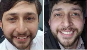 Omar Dental Clinic & Care Center