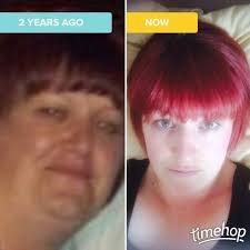 Your inspiring weight loss stories: North East gran gets a new lease of  life