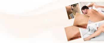 That's why chicagoans greatly appreciate how chicago laser. Best Laser Hair Removal Laser Hair Removal Chicago Illinois