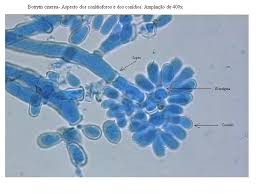 Image result for Botrytis cinerea