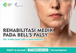Layanan fisioterapi adalah bentuk pelayanan kesehatan yang di tujukan kepada individu dan atau kelompok untuk mengembangkan, memelihara dan meulihkan gerak dan fungsi. Rehabilitasi Medik Pada Bells Palsy