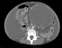 Pet scans provide metabolic information and are increasingly read alongside ct or mri (magnetic resonance imaging) scans, which provide anatomic information. Two Days Abdominal Pain Emergency Physicians Monthly