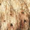 How can i tell which specific std i have? Https Encrypted Tbn0 Gstatic Com Images Q Tbn And9gctkvnsmttrvr7yvp Exhr Vxr7tvpnypyme9rgoav7u062xnvoy Usqp Cau