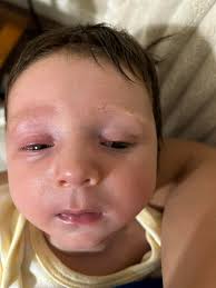 Any dairy-free, low-acid reflux recipes for toddlers?