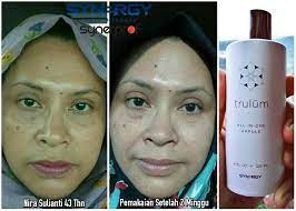 Maybe you would like to learn more about one of these? Trulum Review 08995027427 Trulum Skincare Review Trulum All In One Ampoule Youtube Trulum S Intrinsic Youth Technology Combats The Visible Signs Of Aging At A Foundational Level To Promote A More