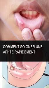 Pin On Astuce Sante