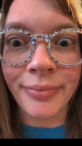 The audio crapped out