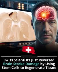 Parkinson's symptoms reversed using lab-grown brain cells In a  groundbreaking breakthrough, scientists have successfully reversed symptoms  of Parkinson's disease using lab-grown brain cells. By transplanting these  specially cultivated neurons into ...