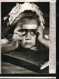 1963 Press Photo Barbara Ortiz at Age 2 With Shiner and Sore Forehead