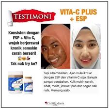 Vitamin c ni adalah vitamin jenis yg larut air dan fungsi utama adalah sebagai antioksidan. Testimoni Esp Vita C Pengedar Shaklee Johor Bahru Facebook