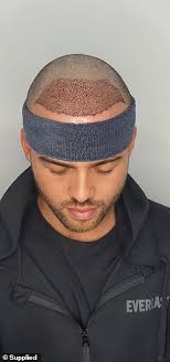 MAFS NZ: Samuel Levi says he feels like a 'completely new person' after  life-changing surgery