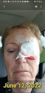 Lost an eye in a friendly drop-in game