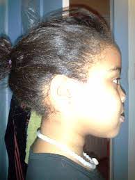 When young black boys get head lice, the shave their heads, and in doing so they effectively remedy the problem. Yes Black Girl You Can Get Head Lice The Finale Toni S Room