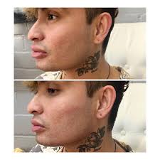 Vanessa Cichon, ACNPC-AG, FNP