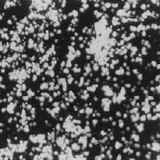 Amorphous Uric Acid Crystals As Seen Under The Phase Contrast Download Scientific Diagram
