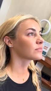 Sculpted. Refined. Timeless. 💋, Lip filler is the art of balance —  elevating your natural beauty with elegance and precision. Think subtle  volume, soft definition, and a finish that feels effortlessly ...