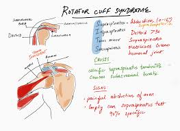 Image result for Rotator Cuff Triad Test