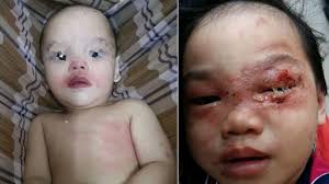 Ubat tidur, kesan dan komplikasinya. Bahaya Semut Charlie Yang Pasti Buatkan Anda Ngeri Membacanya Bidadari My