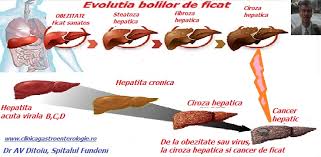 Recomandari privind modificarea de comportament: Purtatorul Sanatos De Virus B Cabinet De Gastroenterologie Si Hepatologie Bucuresti 0758 751 841 Cabinet De Gastroenterologie Si Hepatologie Bucuresti 0758 751 841