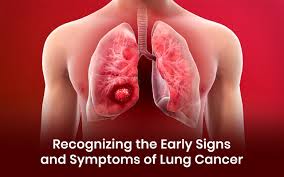 Image result for Cancer Symptom