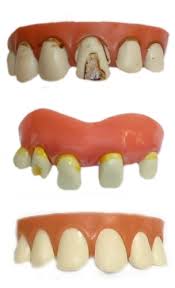 Dentier de vampire blanc ce dentier de vampire se compose de quatre crocs blancs et effilés qui peuvent être facilement insérés dans la bouche et sont également faciles à enlever. Dentier Serie 5 Maquillage Halloween Hq0057 Atelier Mascarade
