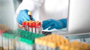 This reading is always the the first or top number. Monocytes High What Does It Mean If Monocytes Are Elevated