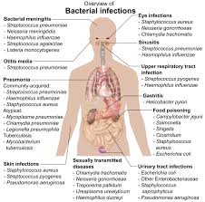 The immune system defends our body against invaders, such as viruses, bacteria, and foreign our immune system is essential for our survival. File Bacterial Infections And Involved Species Png Wikimedia Commons