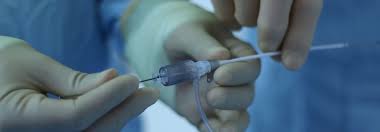 What Is Interventional Radiology Bsir