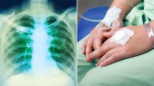 Протокол nccn лимфома ходжкина (лимфогранулематоз) — hodgkin_lymphoma. How Is Hodgkin Lymphoma Treated Everyday Health