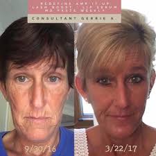 Diane Keaton's experience with skin cancer started in her 20s — and it was  just one of several health challenges she encountered. 😓 DETAILS. ⬇️