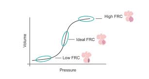 Image result for Functional Residual Capacity
