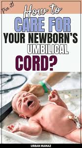 How To Care For Your Newborn S Umbilical Cord Baby Umbilical Cord Newborn Newborn Care