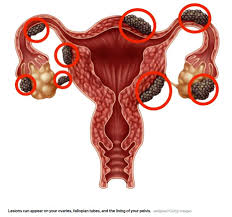 Pelvic Pain One Healthcare