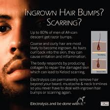 Why am i getting chin hair? chin hair is not rare. Brown Skin Tones Electrolysis Beauty Lounge
