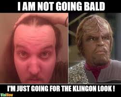 Check spelling or type a new query. How Long Does It Take For A Receding Hairline To Make You Go Bald Visihow