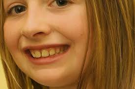 Gallery: Relay for Life wins big with fundraiser