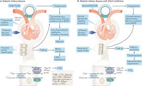 Ckd is a worldwide public health problem. Pathophysiology Of Diabetic Kidney Disease Impact Of Sglt2 Inhibitors Nature Reviews Nephrology