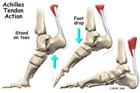 The parallel arrangement of fibers is an adaptation to the fact that. Physical Therapy In Buffalo For Foot Achilles Tendon Problems