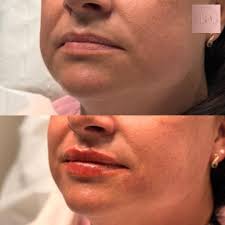 Kelly Hayward (@beautiful_aesthetics_bykelly) • Instagram photos and videos