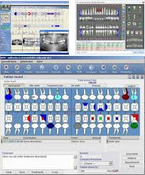 A Dentimax Software B Windent 3d Charting Download