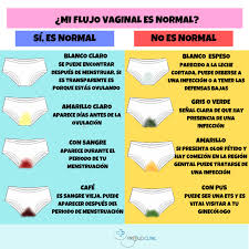 Proud Clinic Si Tu Flujo Vaginal Presenta Caracteristicas No Normales Es Muy Importante Consultar A Un Ginecologo Para Identificar El Problema E Iniciar El Tratamiento Mas Adecuado Recuerda Que Es Muy