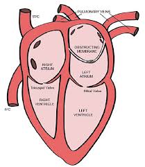 The 2002 action (the spinelli case) is a custody action between rachel mirochnick and mario spinelli, unwed parents of rebecca spinelli, born january 31, 2001, and it concluded on september 23, 2002, with an award of custody of that child to rachel. Cor Triatriatum Case Report Of Emergency Department Diagnosis The Western Journal Of Emergency Medicine