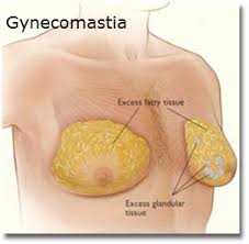 Image result for risperdal