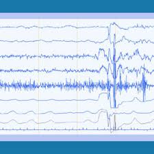 Breathing we explore the use of polygraphs and lie detector tests in general in the law, including the basically, the court addressed the difficulty of determining just when a scientific discovery (such. Polygraph Test Private Investigator
