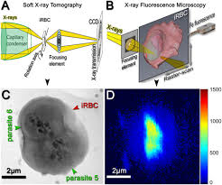 Human parasites under the microscope. Unraveling Heme Detoxification In The Malaria Parasite By In Situ Correlative X Ray Fluorescence Microscopy And Soft X Ray Tomography Scientific Reports X Mol