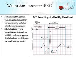 We did not find results for: Elektrokardiografi Ppt Download