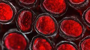 Image result for Red Cell Distribution Width