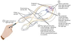 reflex action and reflex arc concepts solved questions and